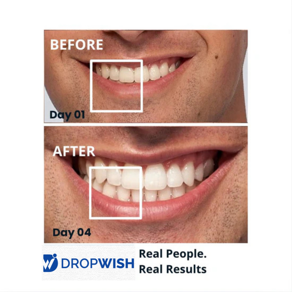 DW® Teeth Whitening Strips