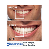 DW® Teeth Whitening Strips