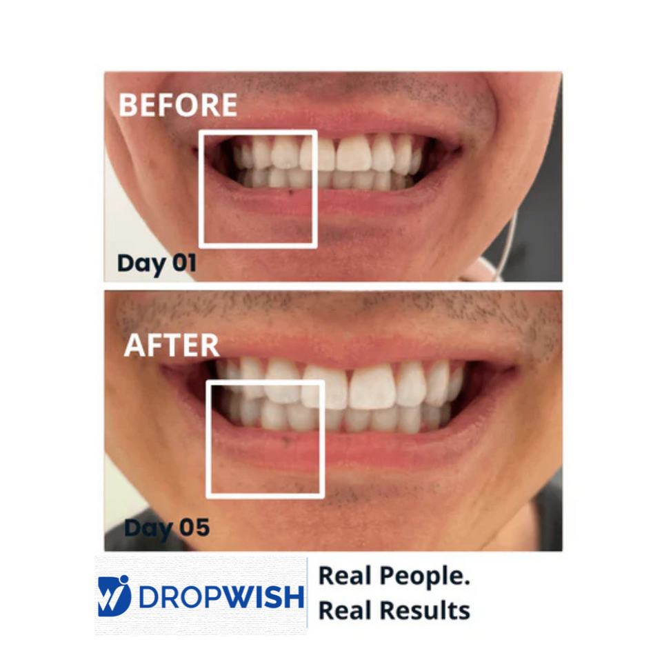 DW® Teeth Whitening Strips