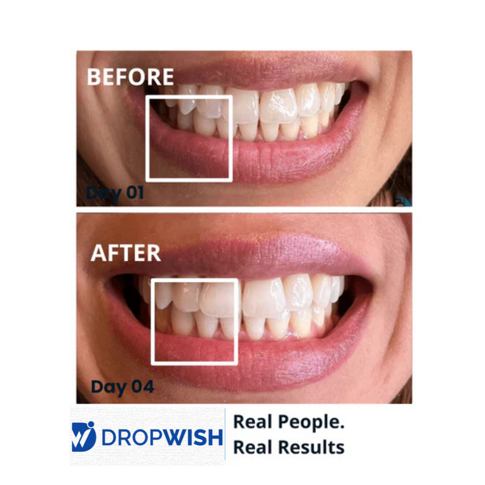 DW® Teeth Whitening Strips