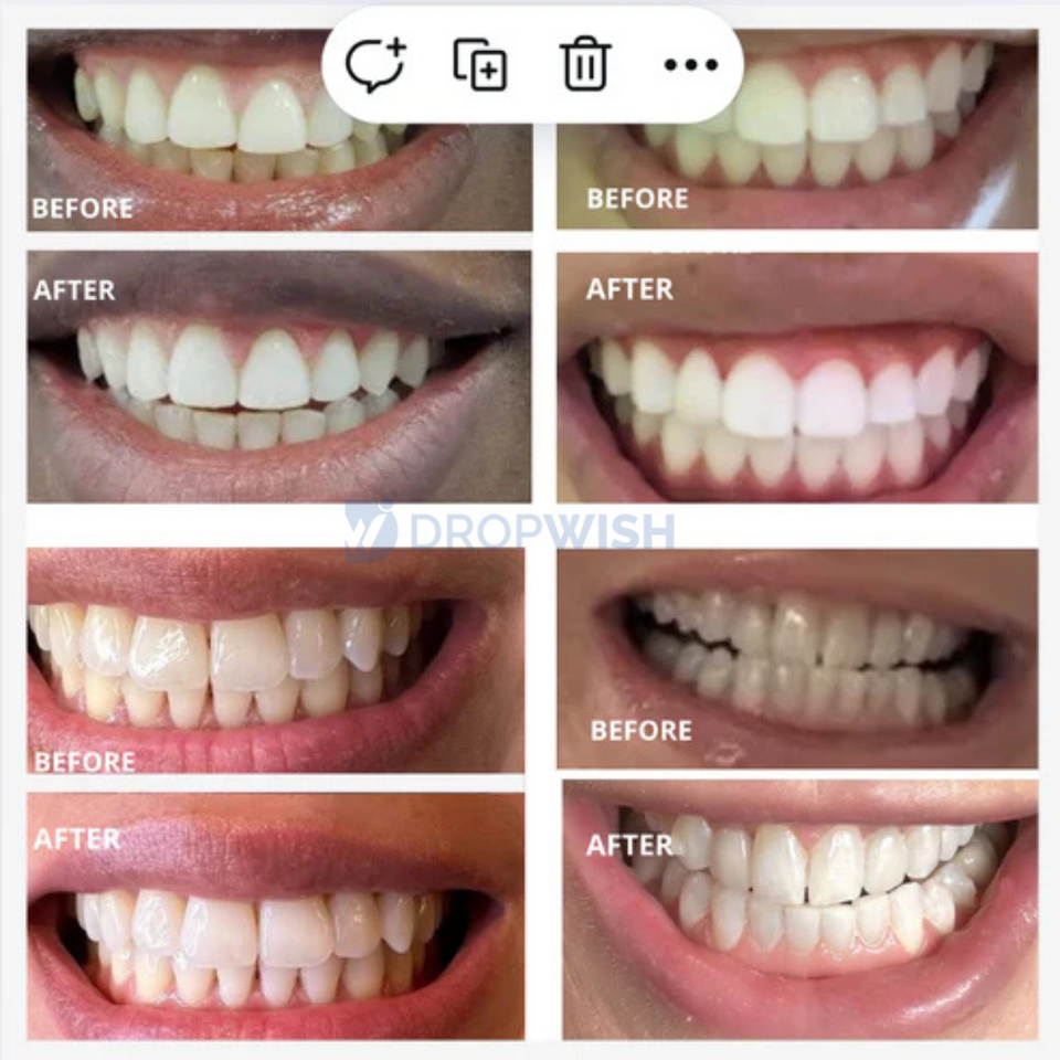 DW® Teeth Whitening Strips