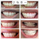 DW® Teeth Whitening Strips