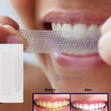 DW® Teeth Whitening Strips